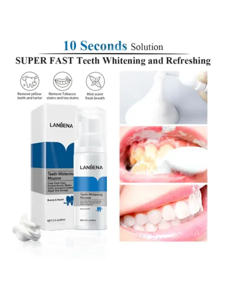 مبييض ومنظف الأسنان